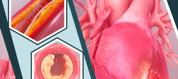 Factors Of Heart Disease