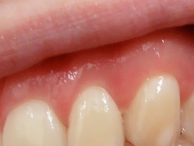 person gums and teeth