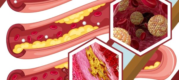 Understanding Cholesterol Levels